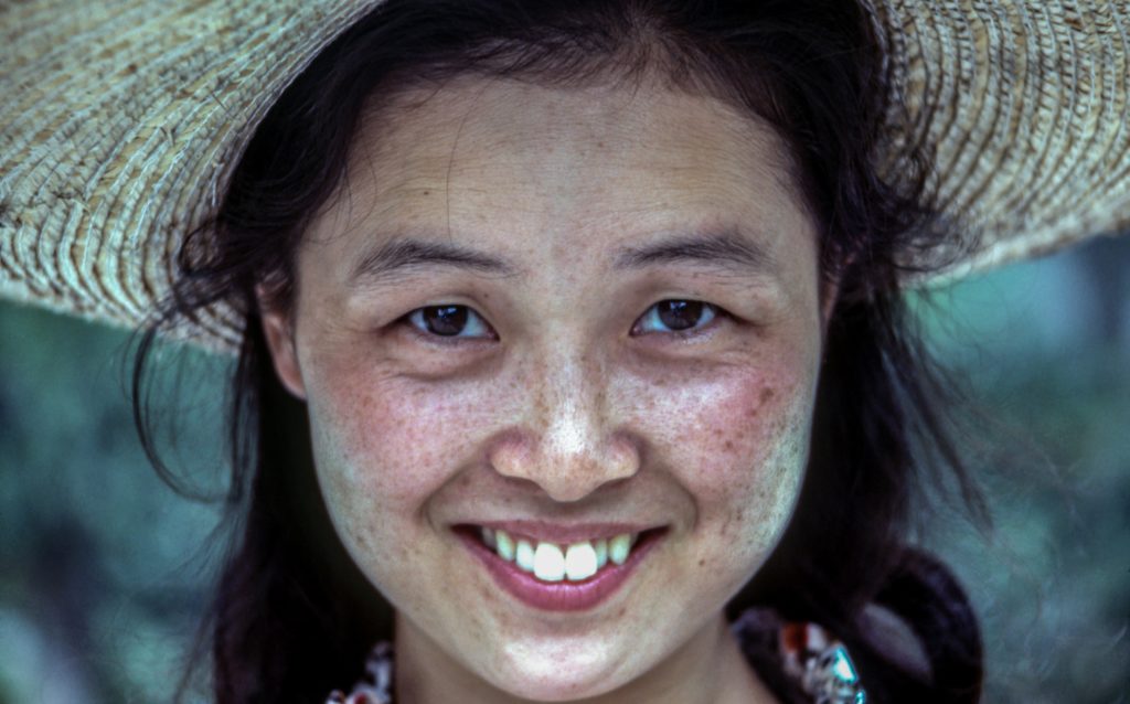 What is Causing Your Blackheads and What You Can Do to Treat Them?