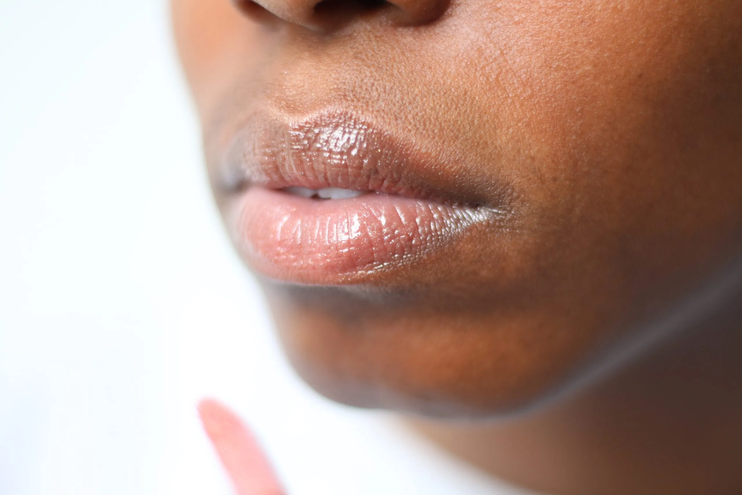 chapped lips How To Treat Chapped Lips In The Winter Weather