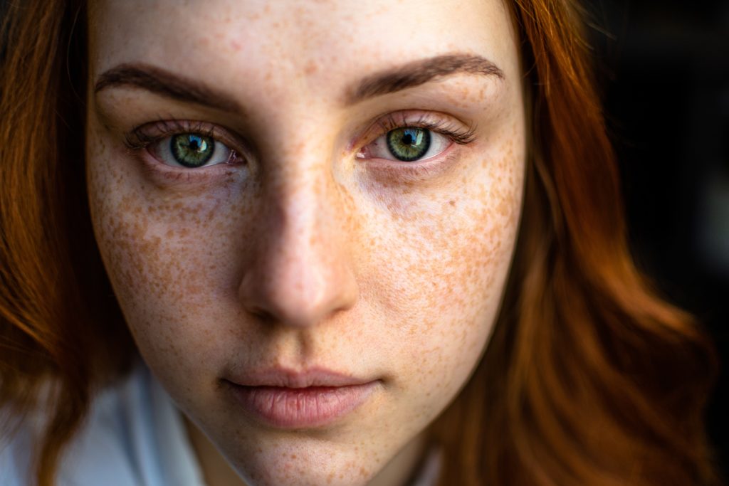Biggest Skincare Mistakes That Are Causing You Acne