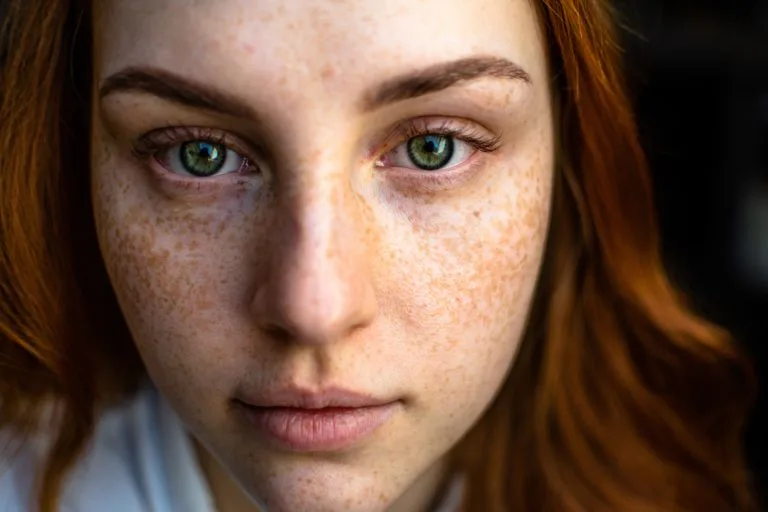 Combat Oily Skin Biggest Skincare Mistakes That Are Causing You Acne