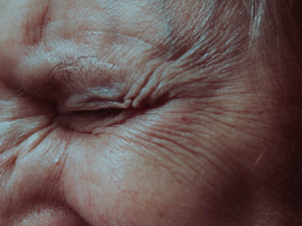 How To Reduce Wrinkles And Dark Circles On Your Face Using Aloe Vera