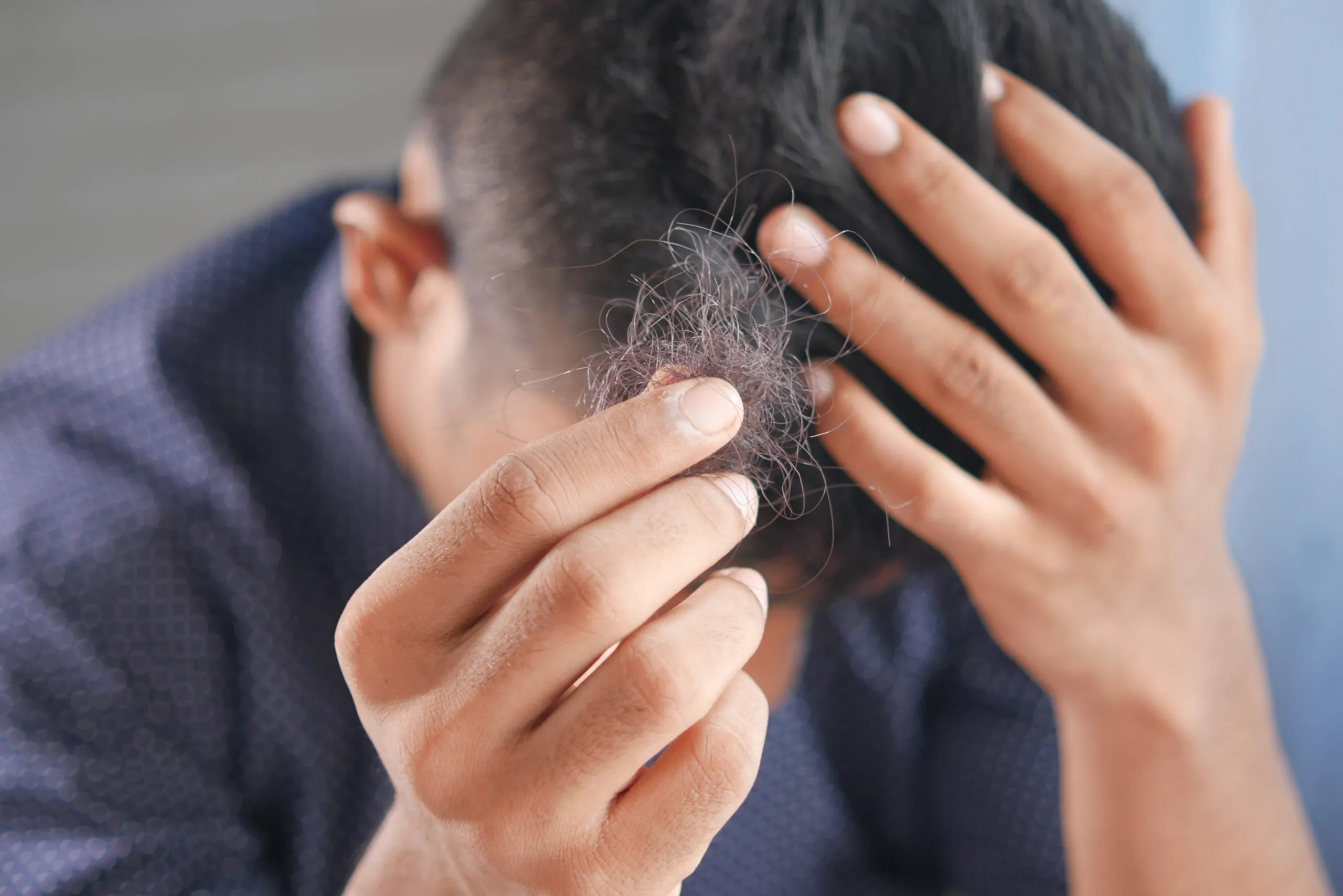 regrow hair on a bald spot Proven Hacks To Regrow Hair On Bald Spot Fast