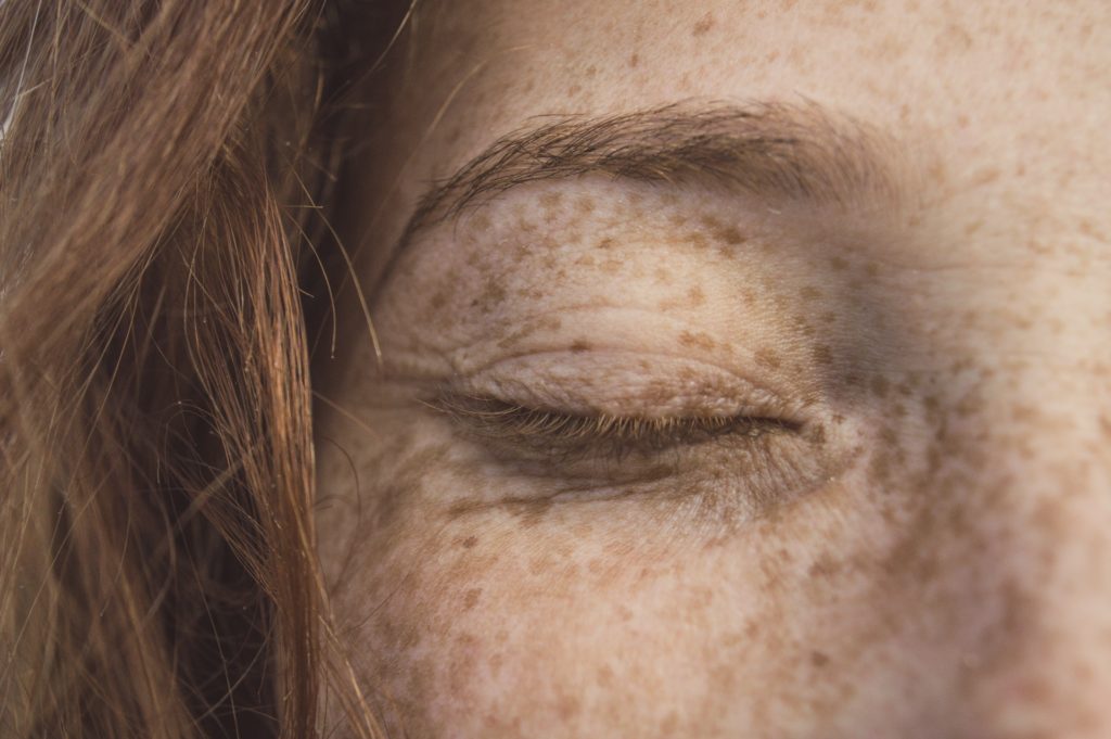 How To Reduce Redness, Irritation, and Inflammation