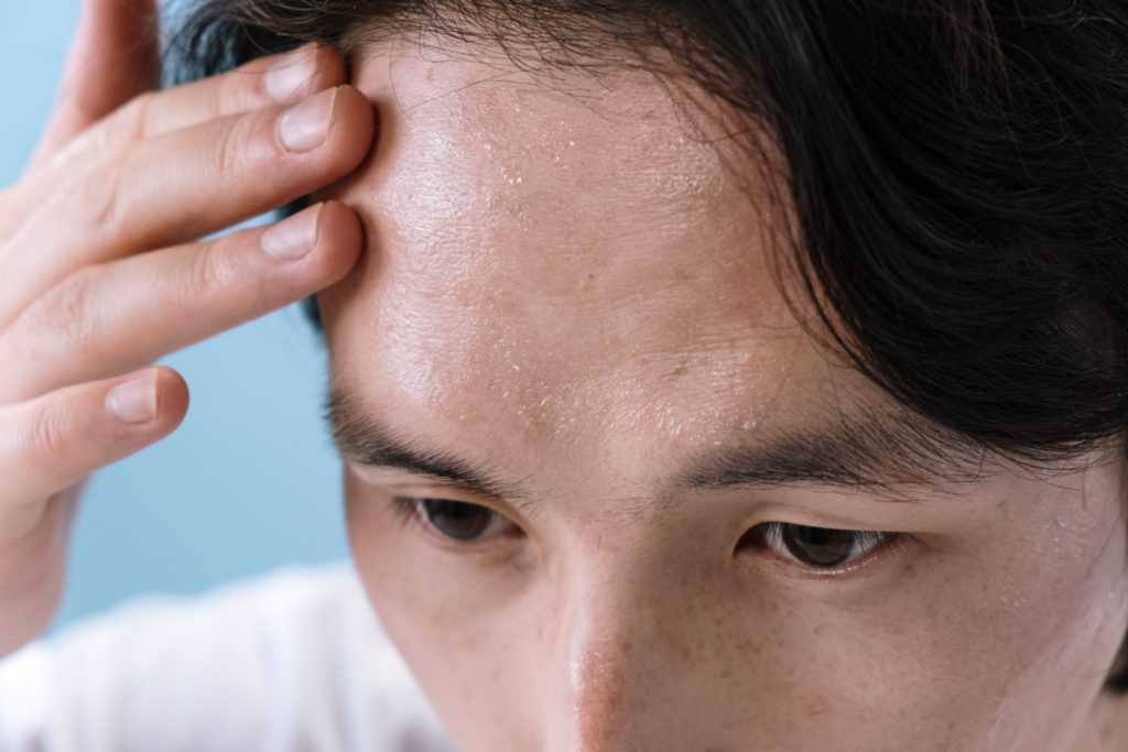 Ways Stress Affects Our Skin