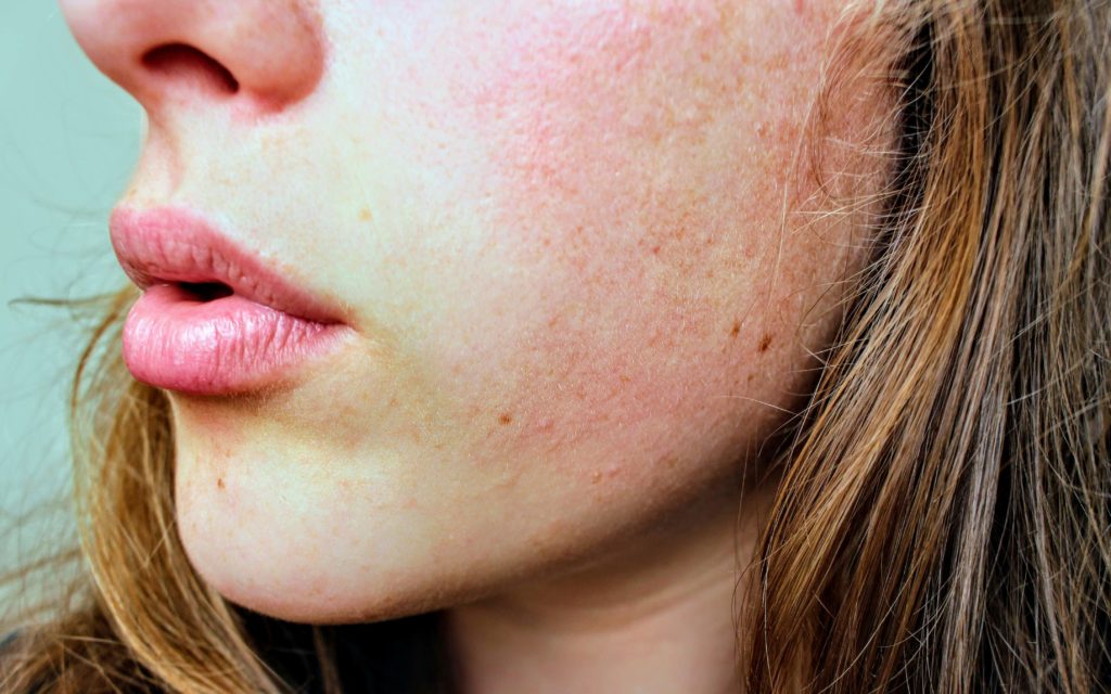 The Impact of Environmental Pollution on Skin