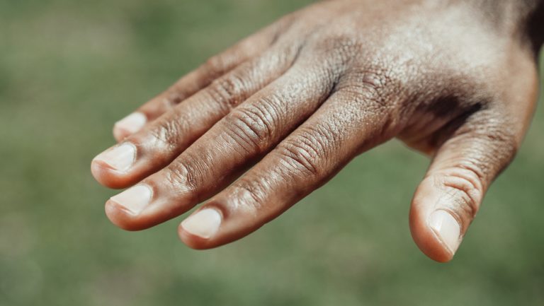 The Connection Between Nutrition and Strong Nails