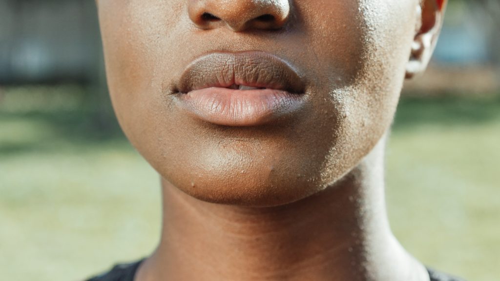 How To Treat Hyperpigmented Lips