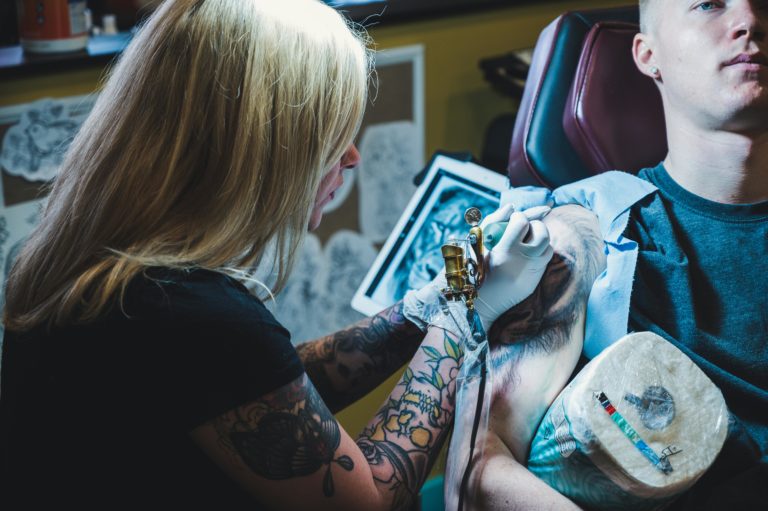 Science of Tattoo Removal Techniques