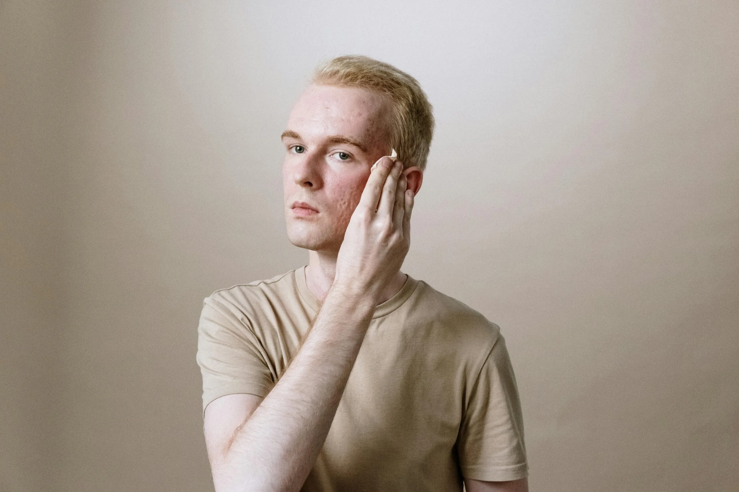 Importance of Regular Chemical Peels for Skin Renewal Importance of Regular Chemical Peels for Skin Renewal