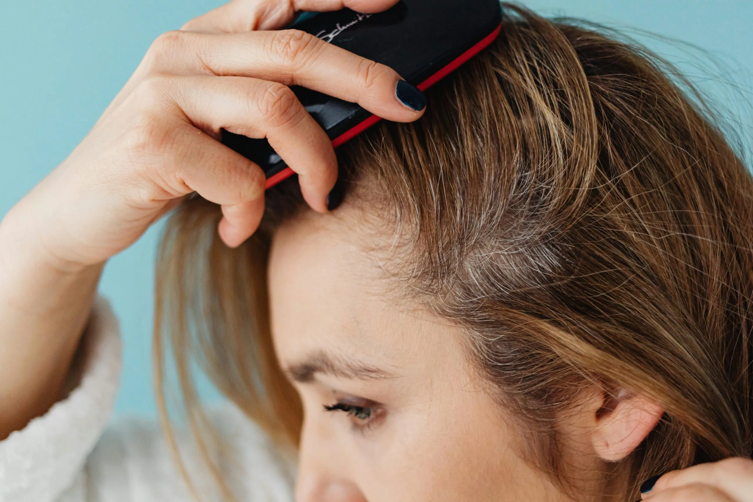 Scalp Psoriasis Solutions Scalp Psoriasis Solutions: Soothing and Managing Flare-Ups