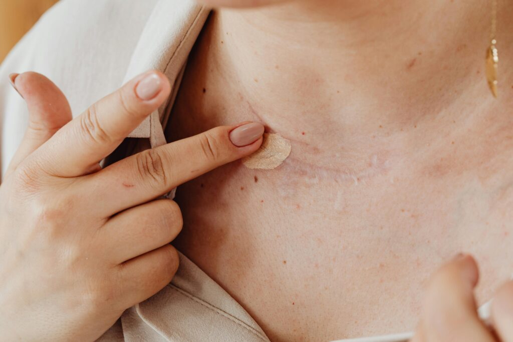 Benefits of Using Color-Correcting Concealers for Skin Imperfections